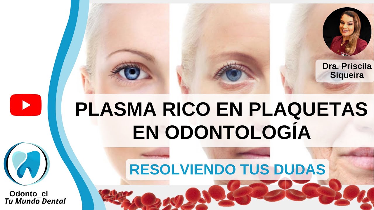 PLASMA RICO EN PLAQUETAS l USO EN ODONTOLOGÍA