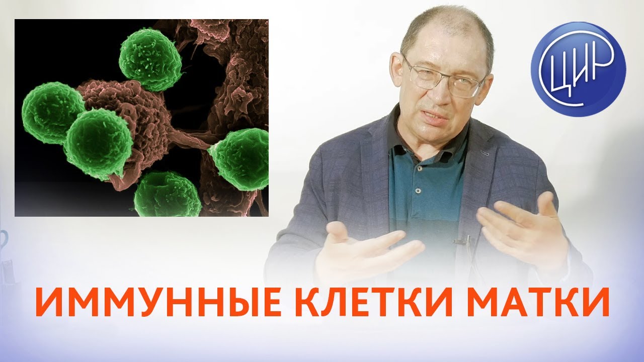 Хронический эндометрит и иммунные клетки матки. Клетки CD-138, как маркёр хронического эндометрита.