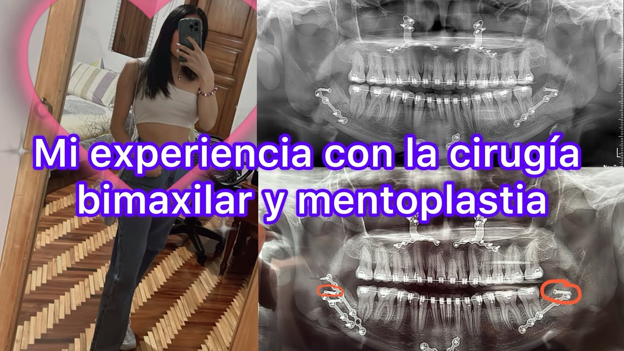 Mi experiencia con Cirugía Maxilofacial y consejos 🥲