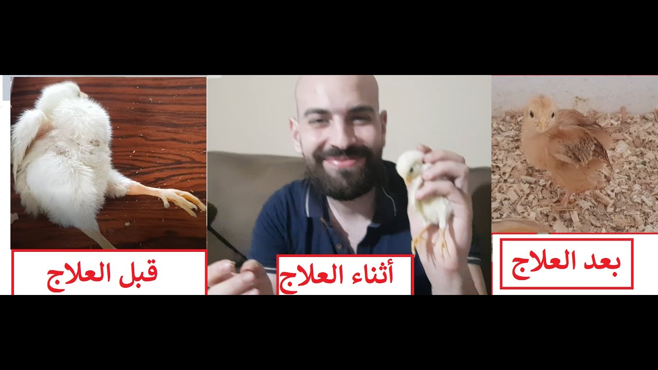شلل رجلين الصوص -  الحل الفعال