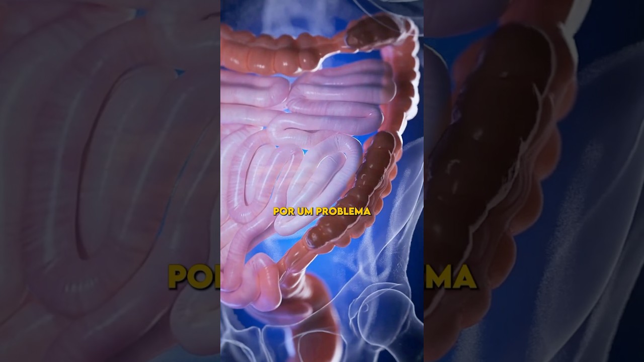 Voc&ecirc; sofre ou j&aacute; sofreu de constipa&ccedil;&atilde;o intestinal? #constipacao #intestino #saude