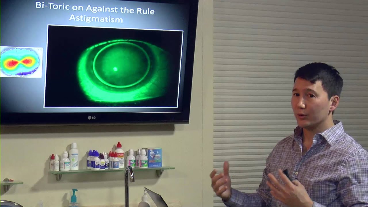 Corneal Topography & Specialty Contact Lenses - Randy Kojima