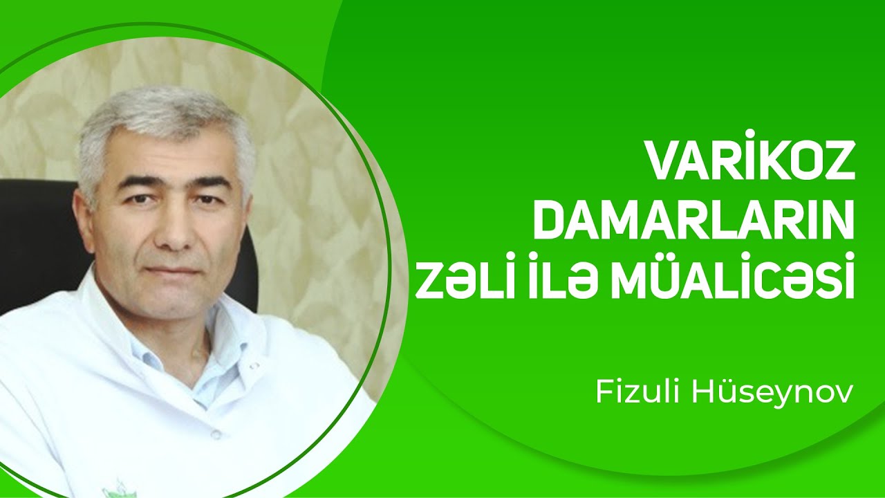 Varikoz damarların Zəli ilə müalicəsi | Fizuli Hüseynov