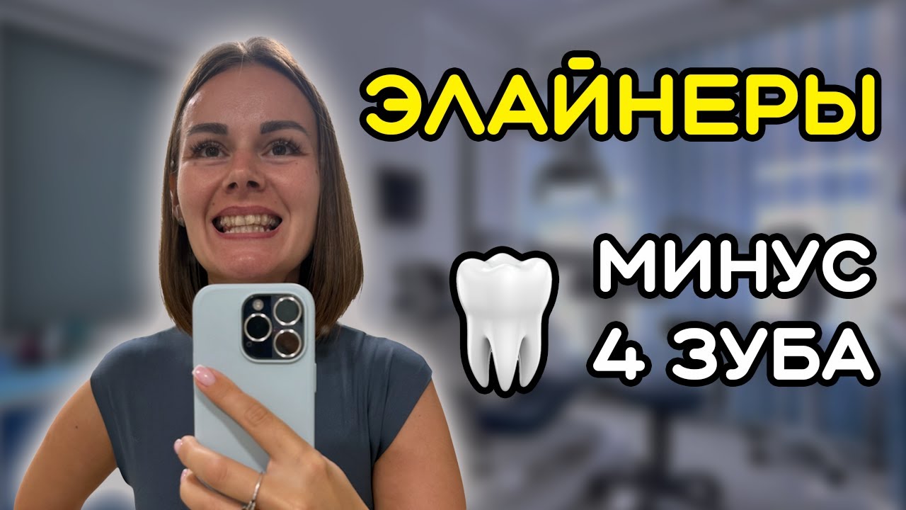 Потеряла зубы? Мой опыт с элайнерами