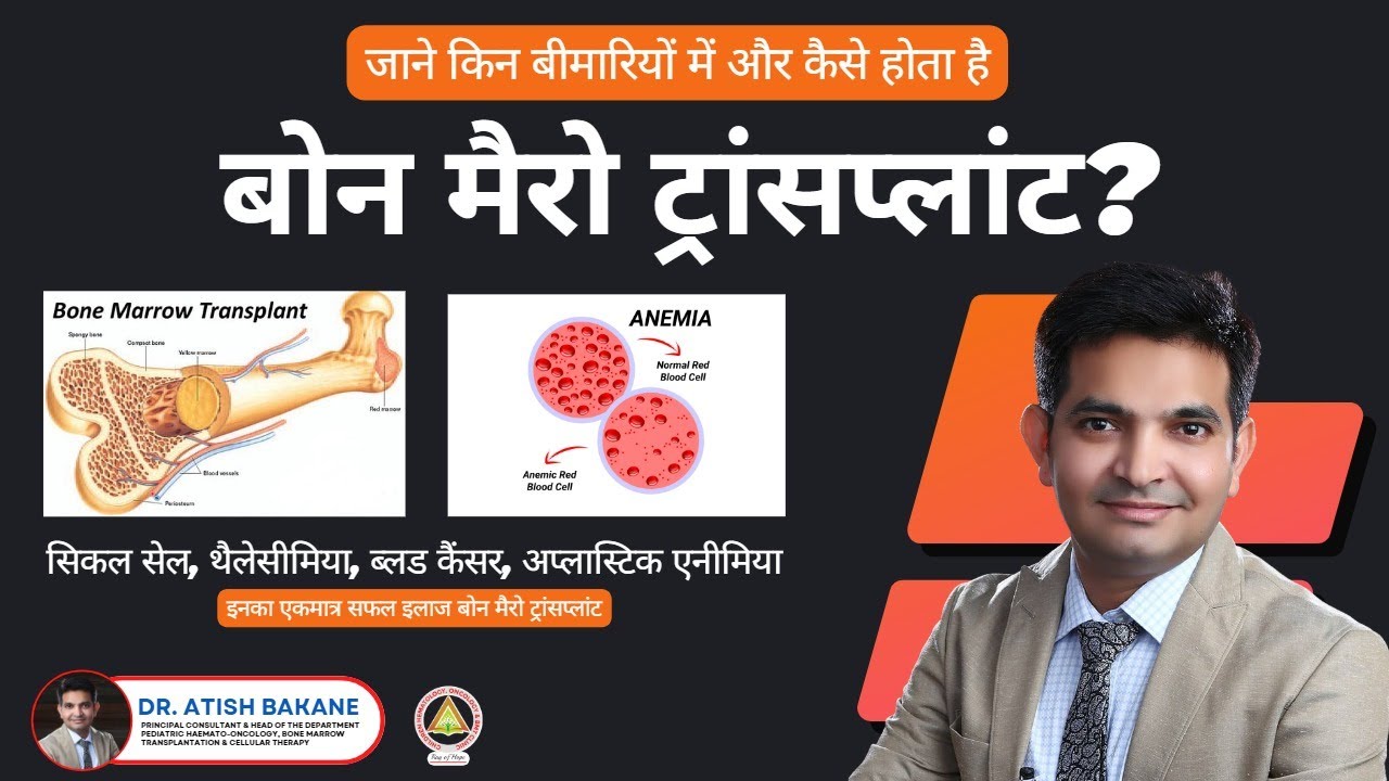 जाने किन बीमारियों में और कैसे होता है बोन मैरो ट्रांसप्लांट?
