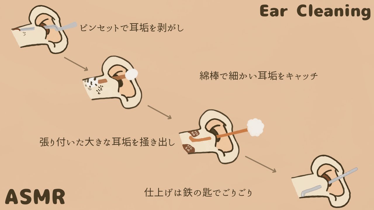 【ASMR】ピンセットで耳垢を剥がし 綿棒で細かい耳垢をキャッチ 耳壁に張り付いた大きな耳垢を掻き出し 仕上げは鉄の匙でごりごり Ear Cleaning 【No Talking】