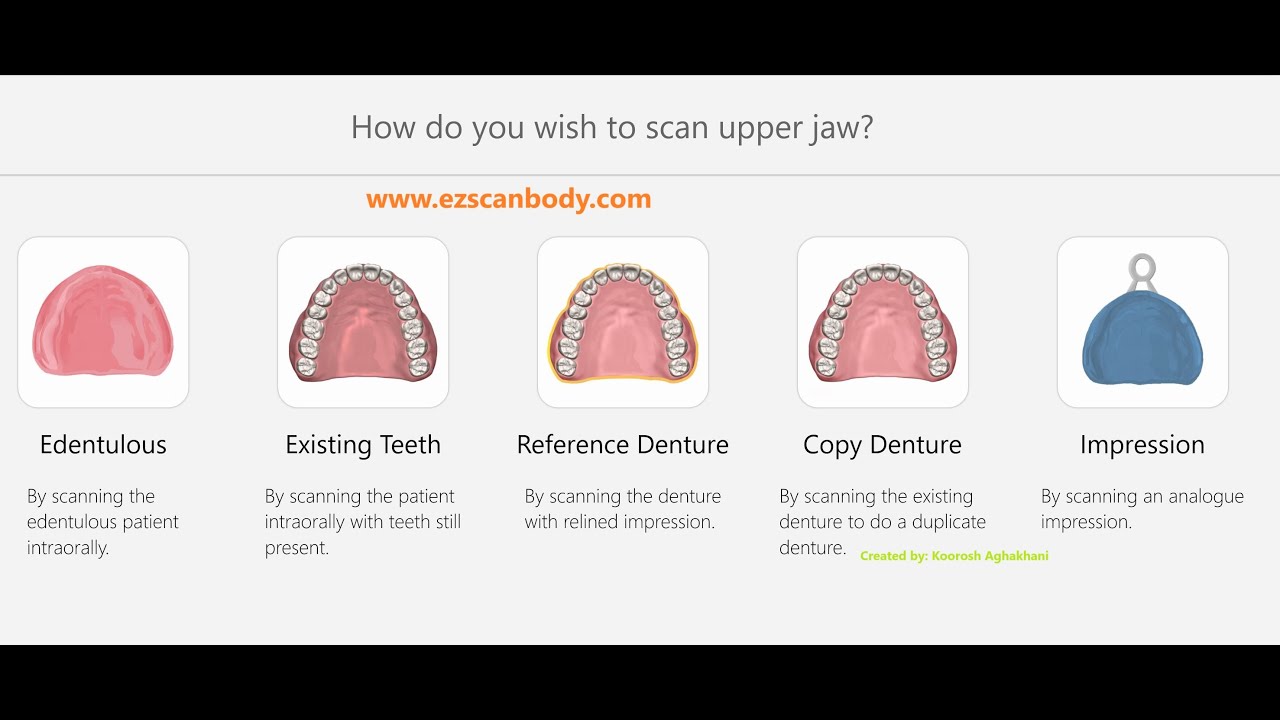 Scanning Protocols for Digital Dentures and Edentulous Jaws