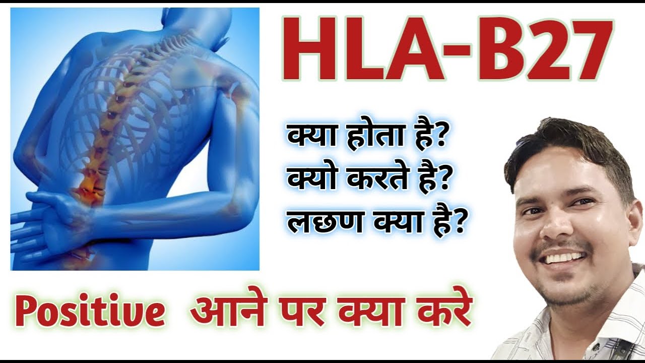 What is HLA B27  | HLA  b27 test in hindi | HLA B27 symptoms