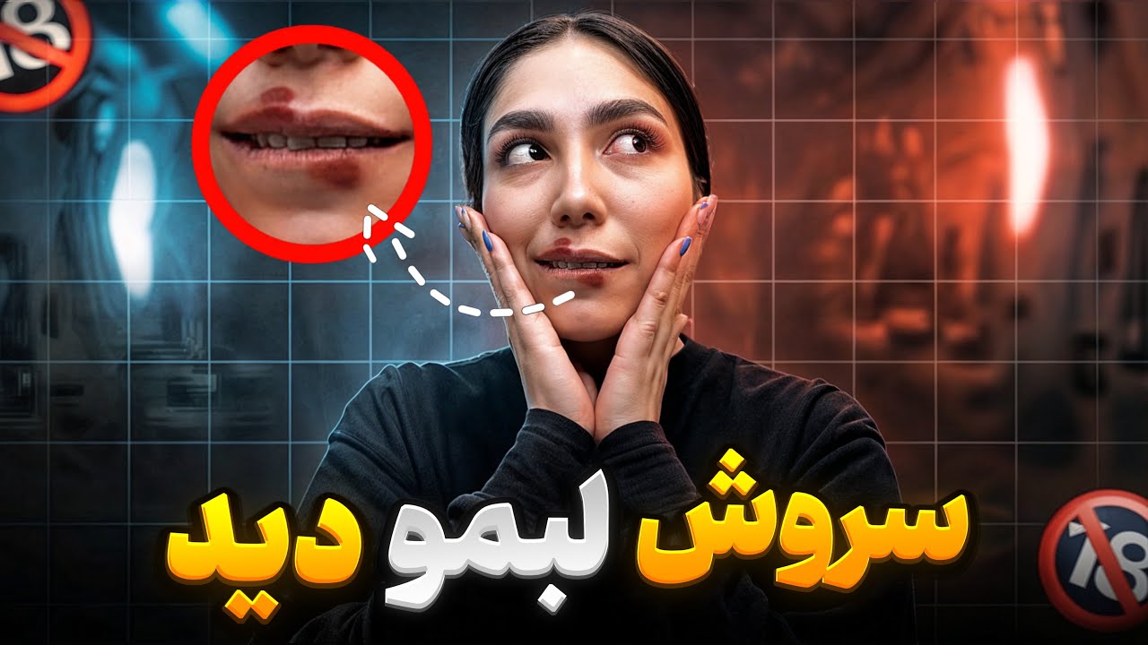 لبم کبود شده🤦🏻‍♀️سروش قاطی کرد زنگ زد مامانم😂
