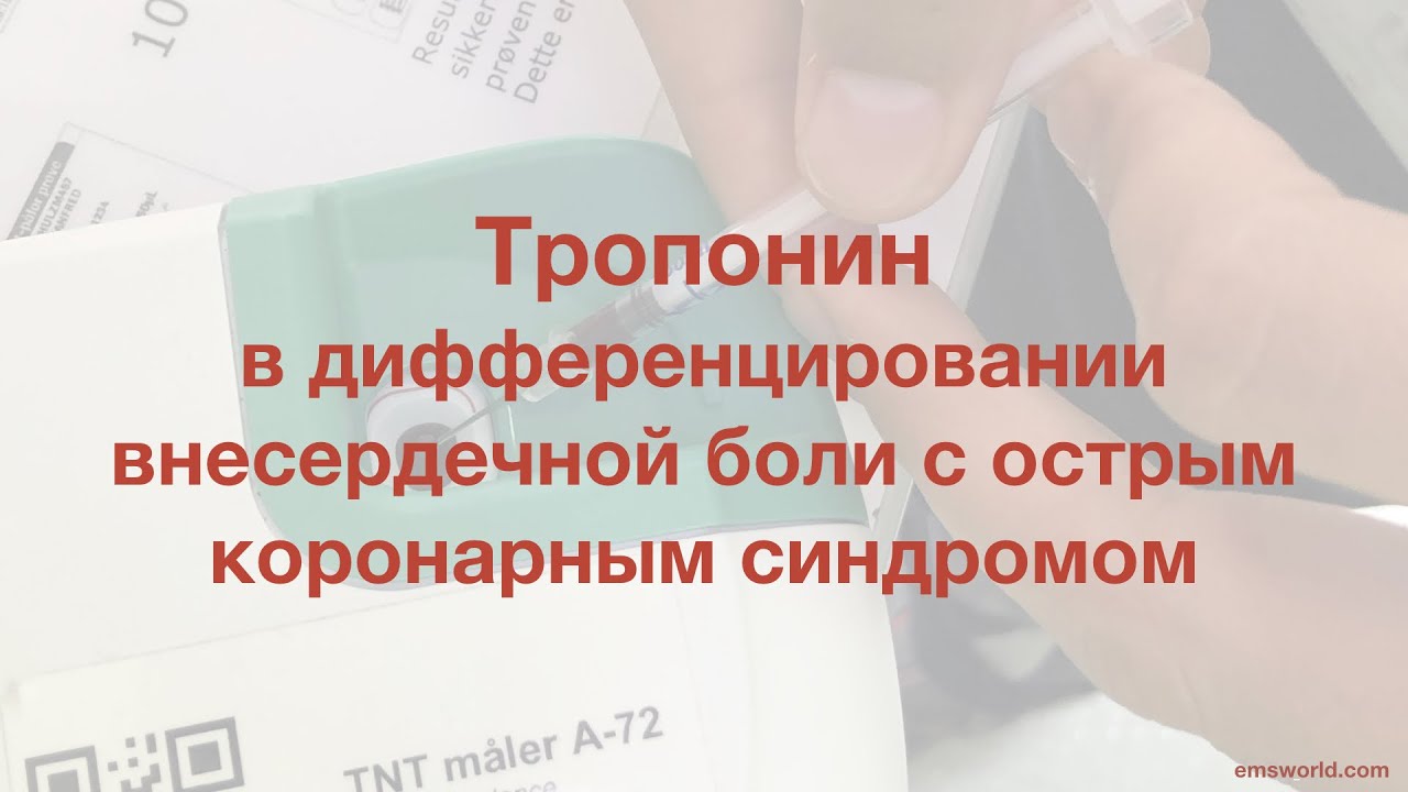 Тропонин в дифференцировании внесердечной боли с острым коронарным синдромом