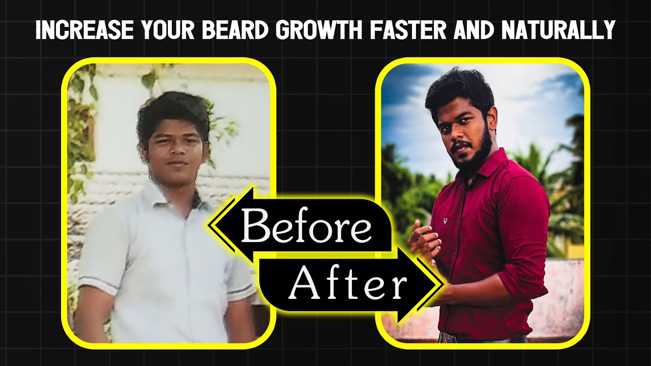 HOW TO GROW A BEARD FASTER NATURALLY | Grooming Tips | RABIRAJ'S LIFESTYLE