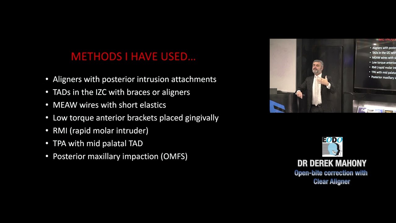 Open-bite correction with Clear Aligner lecture with Dr Derek Mahony