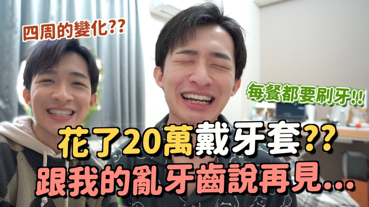 我開始戴牙套了！隱形牙套的優缺點？總共要戴多久？需要的程序有哪些～我的牙套日記