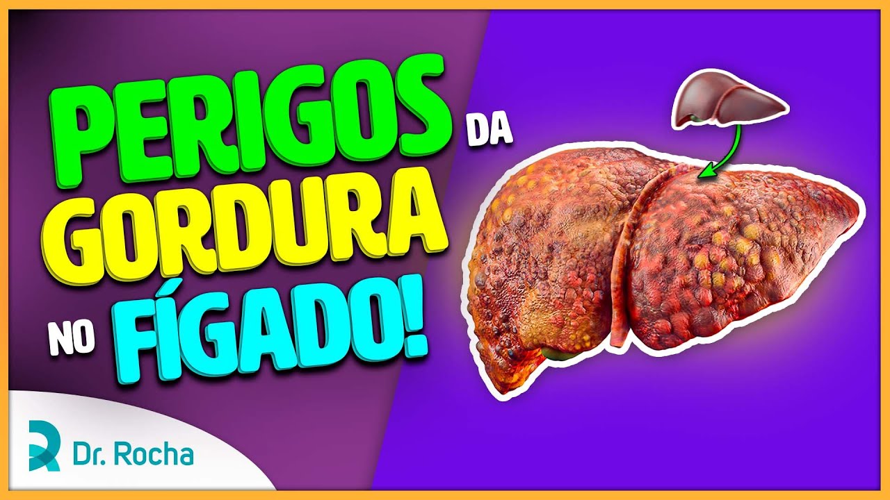 Os 7 Maiores PERIGOS Da GORDURA No FÍGADO - O 2º é o PIOR DELES 😟👎