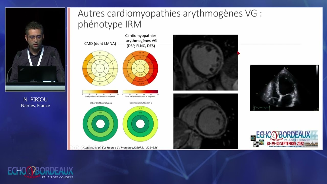 Apports diagnostique et pronostique de l’imagerie multimodale dans l’insuffisance cardiaque