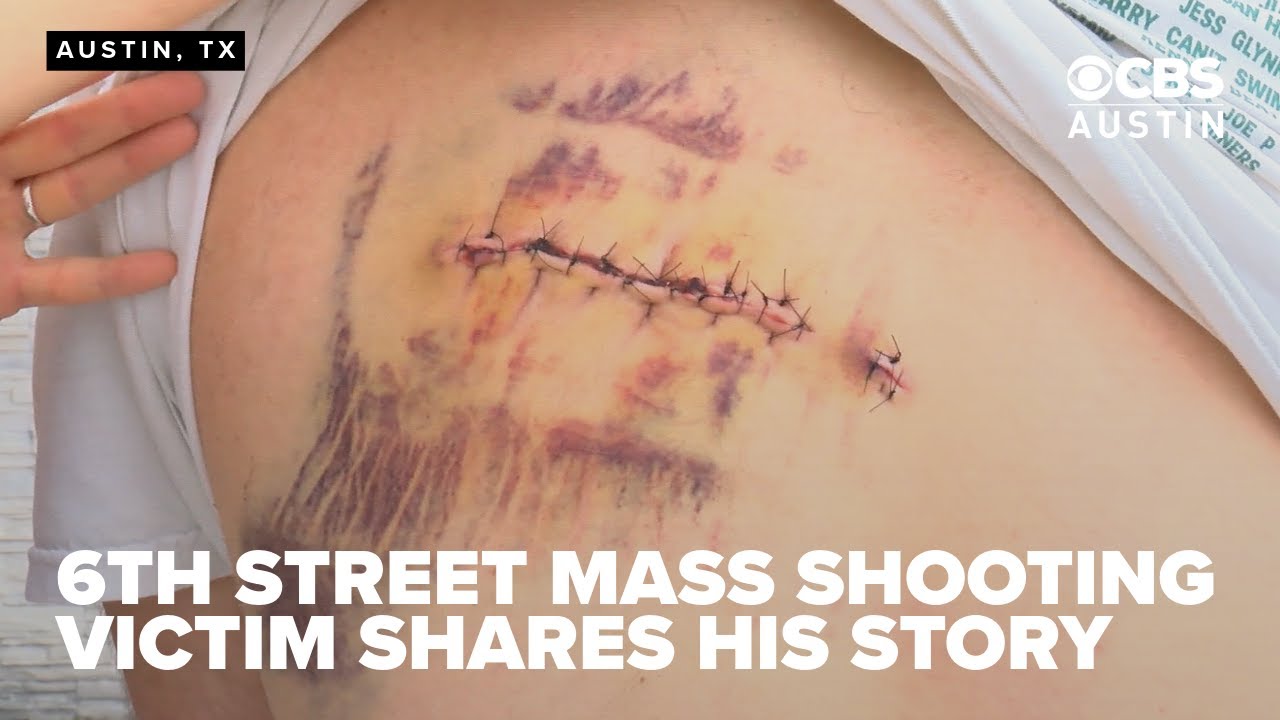 Austin man shot on West Sixth Street seeks strangers who helped save his life