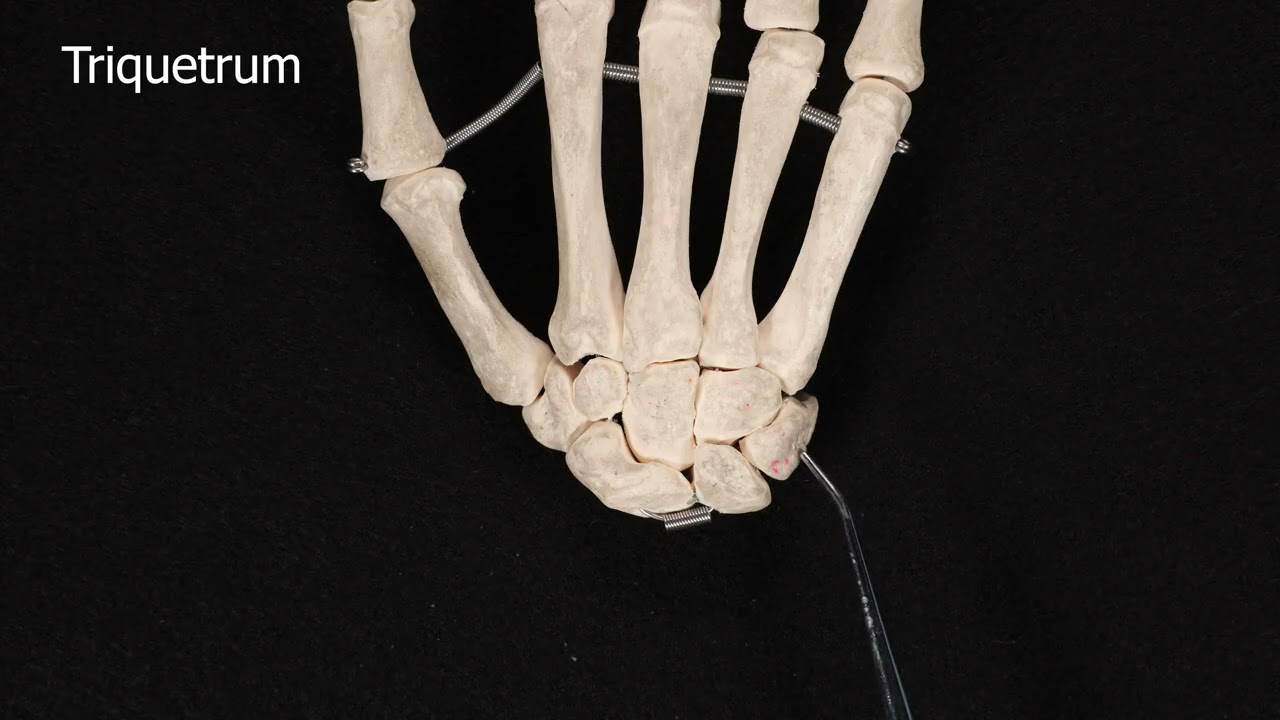 Hand Bones --- Carpals - Metacarpals - Phalanges #skeletalsystem