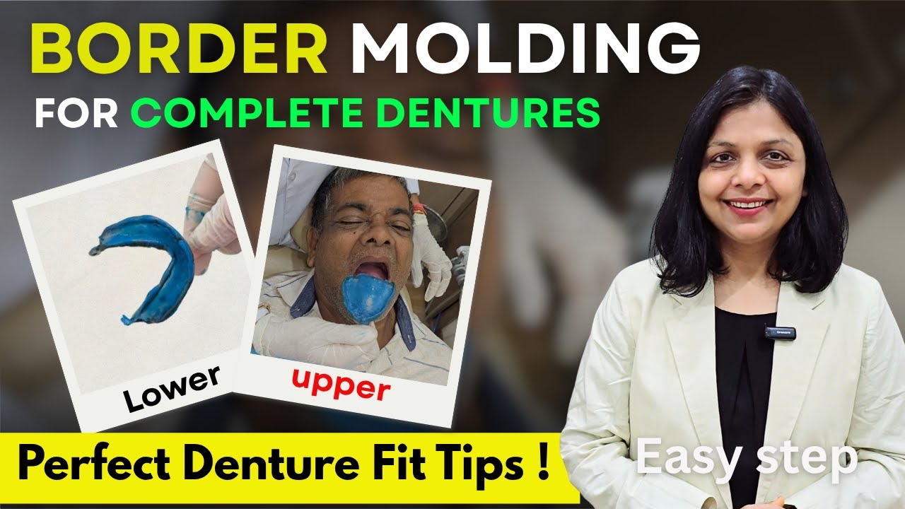 Border Molding for Complete Dentures 🦷 | Perfect Seal & Comfort Fit | Denture Loose नहीं होगा अब !