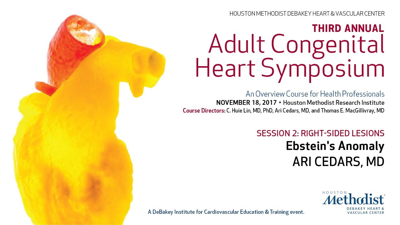 Ebstein's Anomaly (ARI CEDARS, MD)