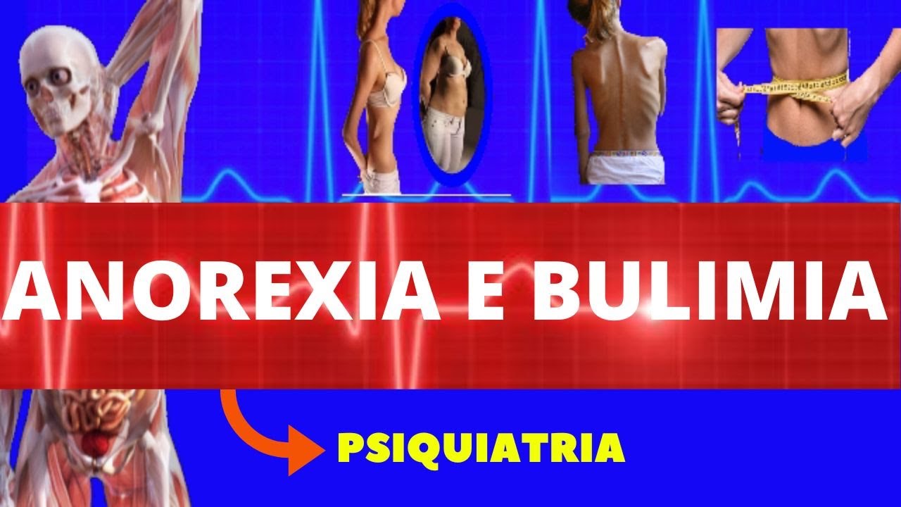 ANOREXIA E BULIMIA NERVOSA - CAUSAS, SINTOMAS, DIAGNÓSTICO E TRATAMENTO - DISTÚRBIOS ALIMENTARES