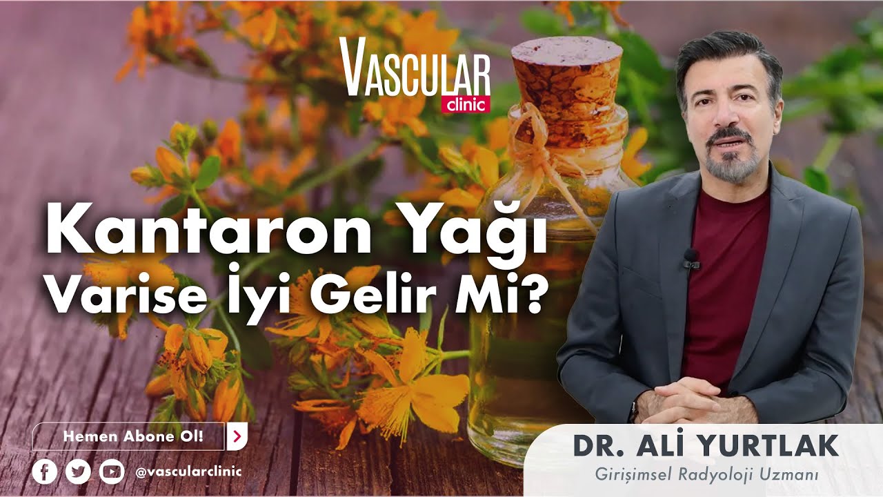 Kantaron Yağı Varise İyi Gelir Mi? | Girişimsel Radyoloji Uzmanı Ali Yurtlak