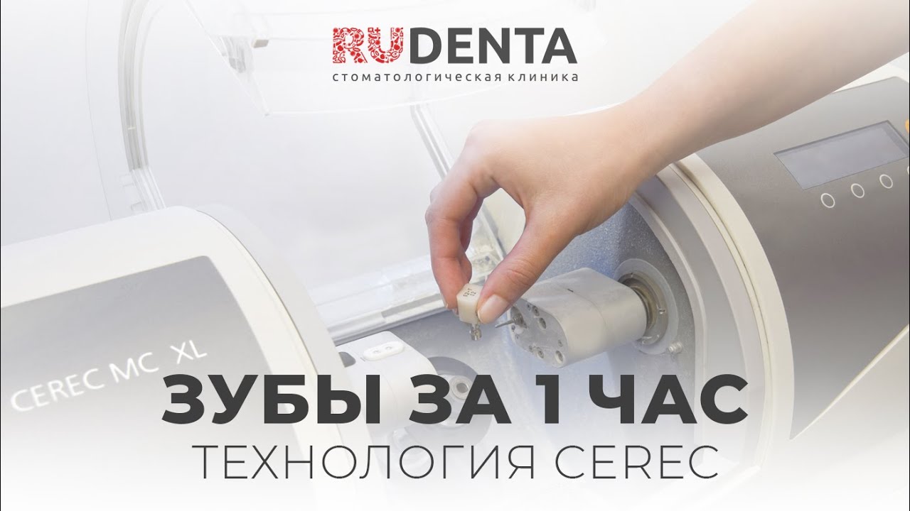 Коронка за 1 час? ЭТО РЕАЛЬНО! Новинка в Рудента: технология CEREC
