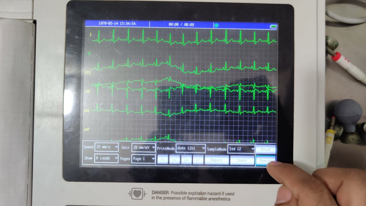 Twelve Channel ECG Machine