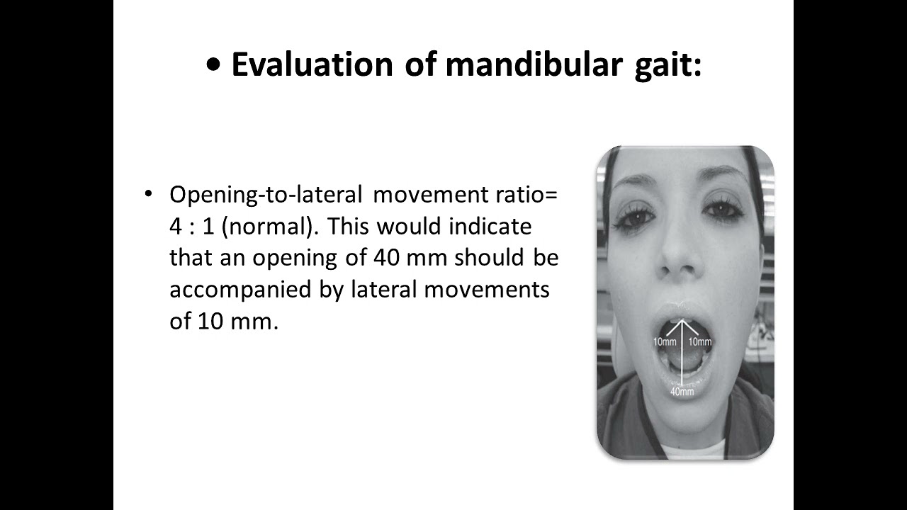 PART 4   DIAGNOSIS OF INTERNAL DERANGEMENT