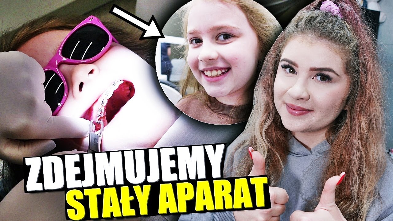 OLIWIA ZDEJMUJE STAŁY APARAT 💜 METAMORFOZA ZĘBÓW