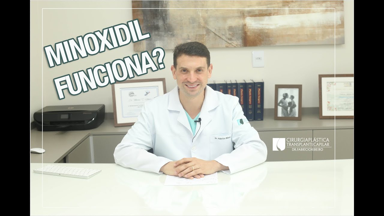 MINOXIDIL FUNCIONA? SEGREDO REVELADO!