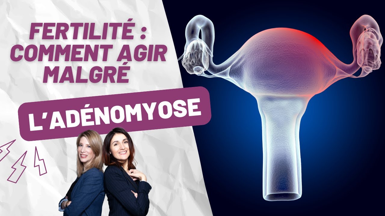 Adénomyose, les clés pour améliorer l'implantation