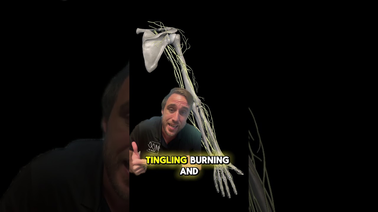 How to resolve Numbness Tingling and burning down your arms?! #numbness #tingling #fyp