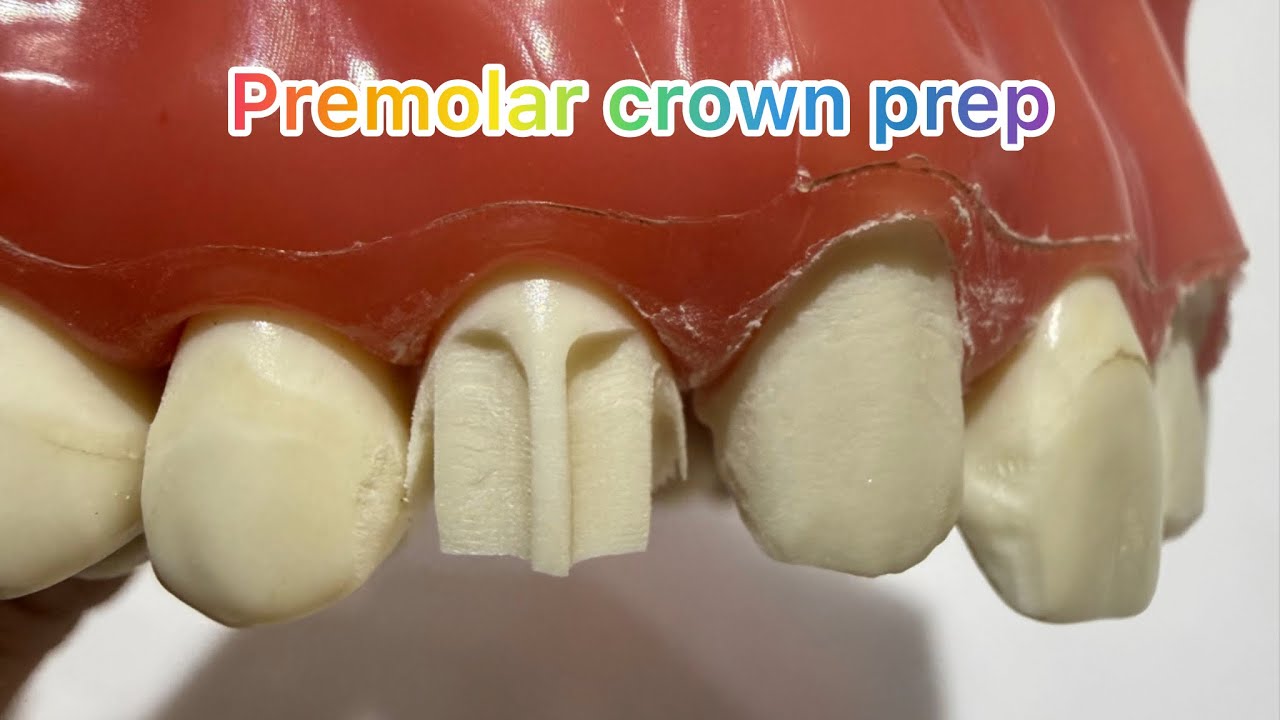 🦷✨ Step-by-step Maxillary Premolar Crown Preparation | Dr.Dentique-hub