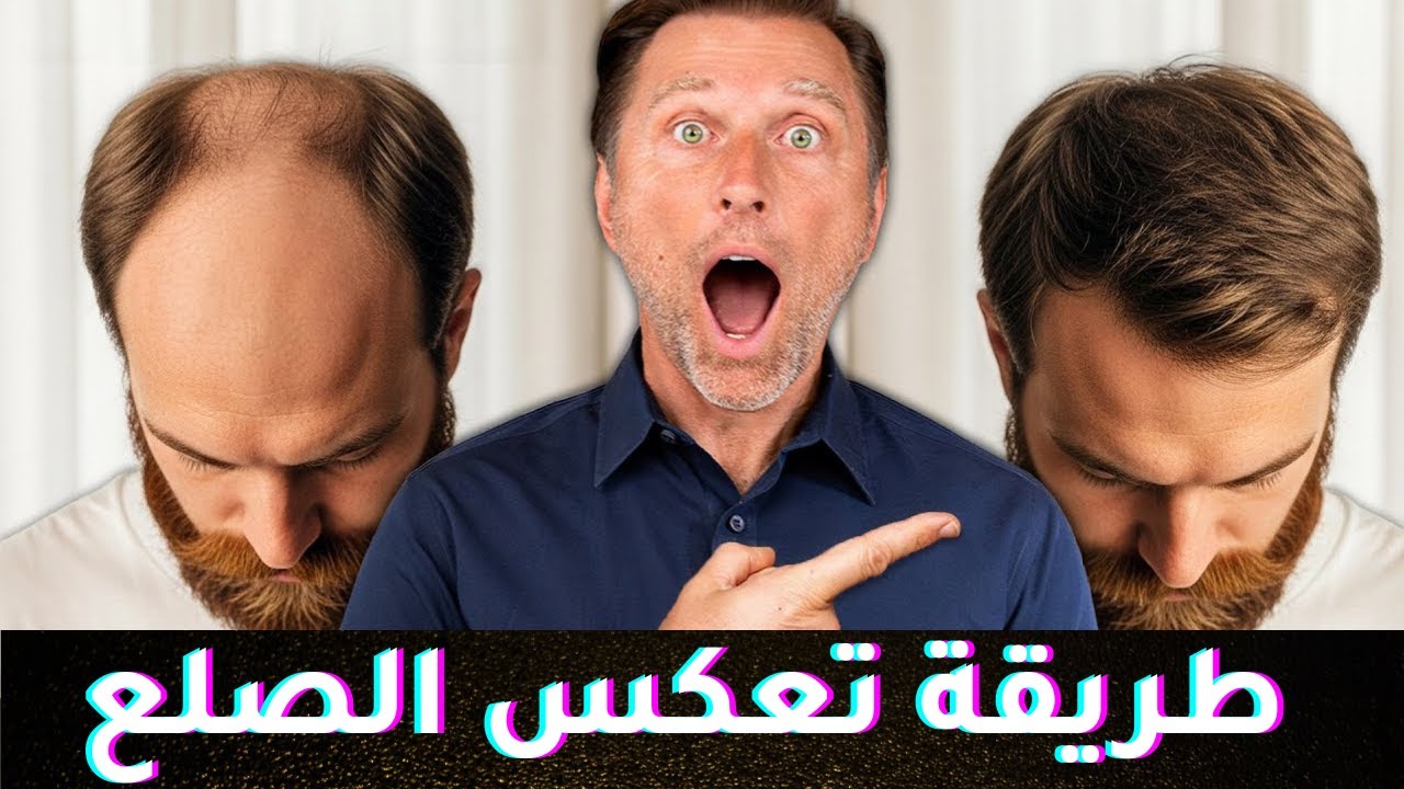 طريقة طبيعية تعكس التساقط إلى نمو الشعر | غذاء البصيلة