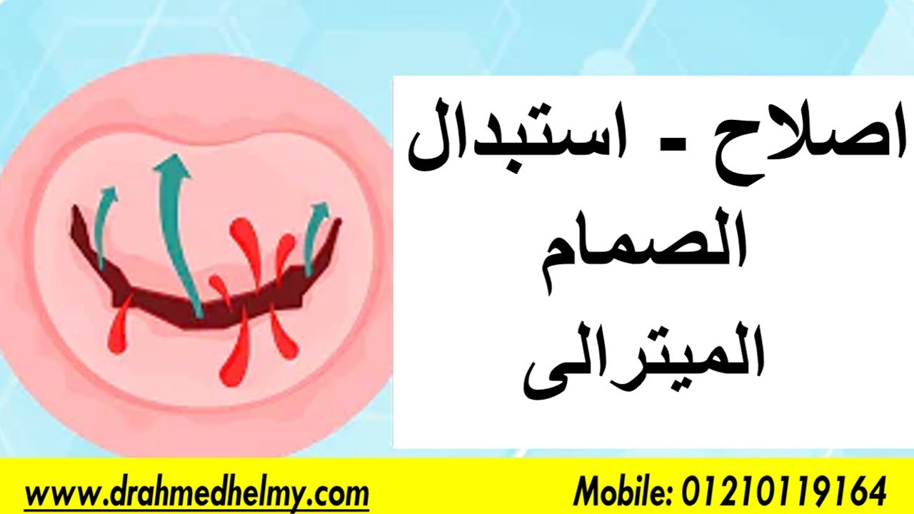 أيهما أفضل اصلاح أم استبدال الصمام الميترالى