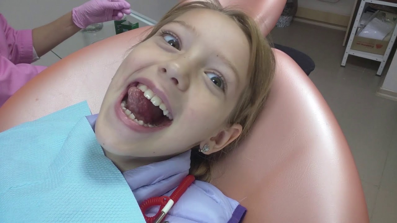 Стоматолог- 2 серия. At the dentist. Best dentist.We the love generation.Супер зубной врач.