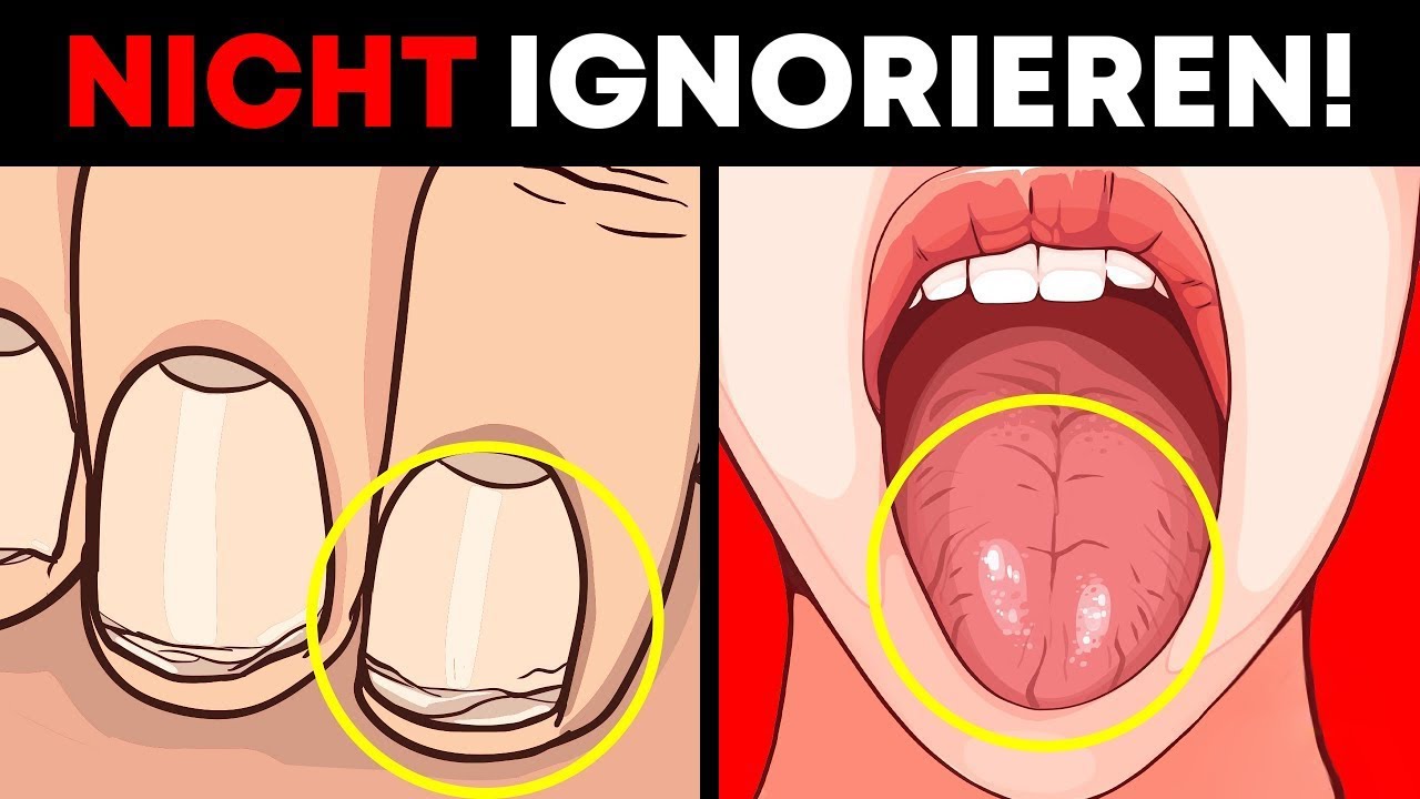 H&auml;moglobin: Diese Anzeichen NIEMALS ignorieren!
