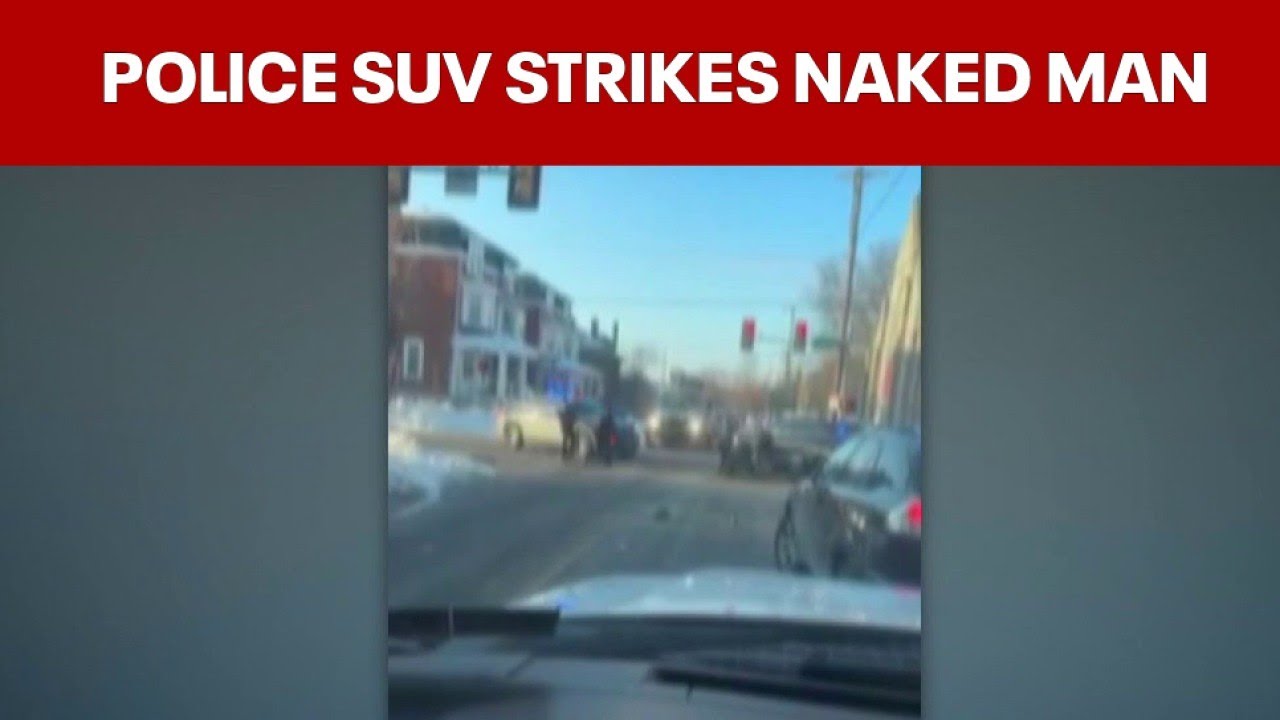 Police SUV strikes naked man during response; officer on leave