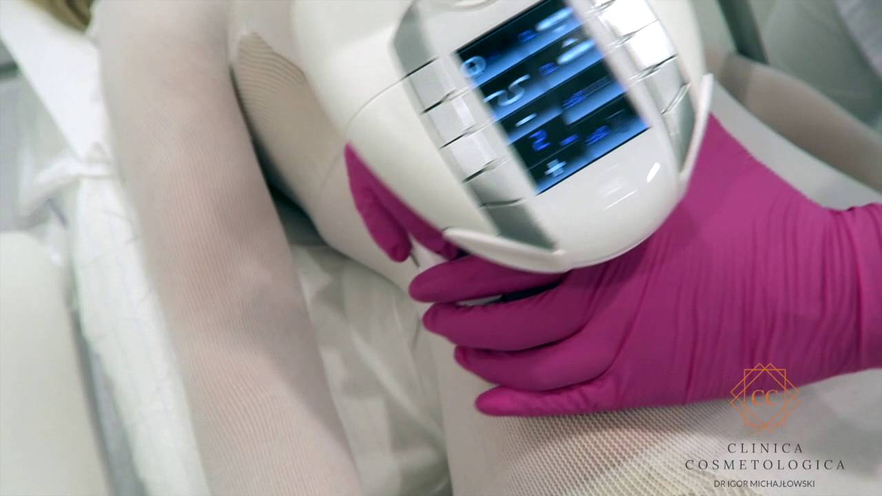 Endermologia LPG ➜ ZABIEG NA BRZUCH - Cellu M6 Integral. Clinica Cosmetologica dr Igor Michajłowski