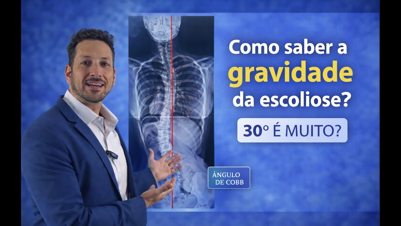 Escoliose leve, moderada ou grave? Como identificar 📏📊⚠️