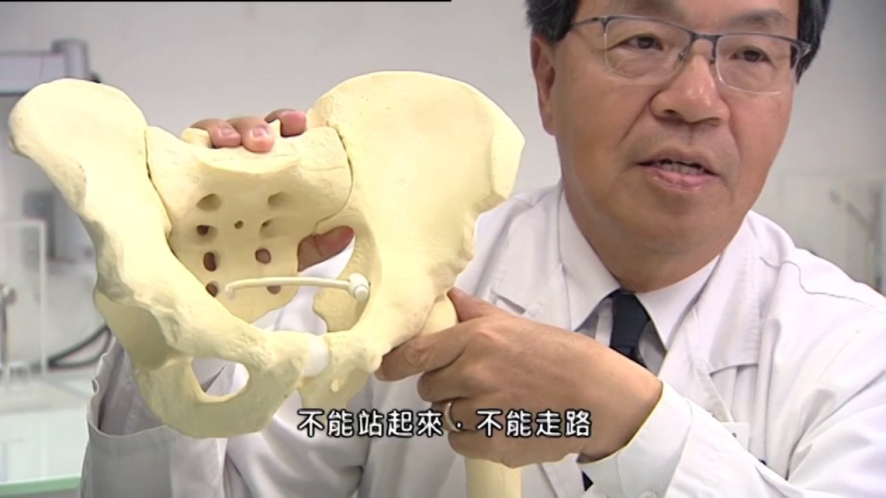 【杏林在線】預防脆性骨折