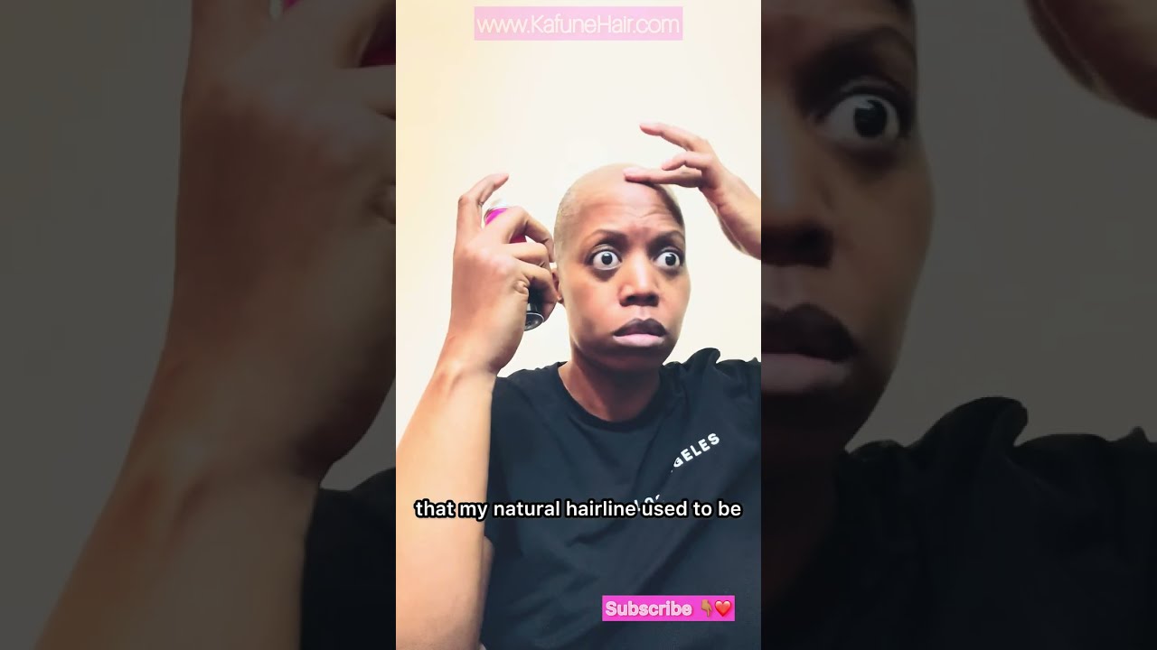 How to Install a Lace Wig with Alopecia | Fast & Gentle 15-Minute Method