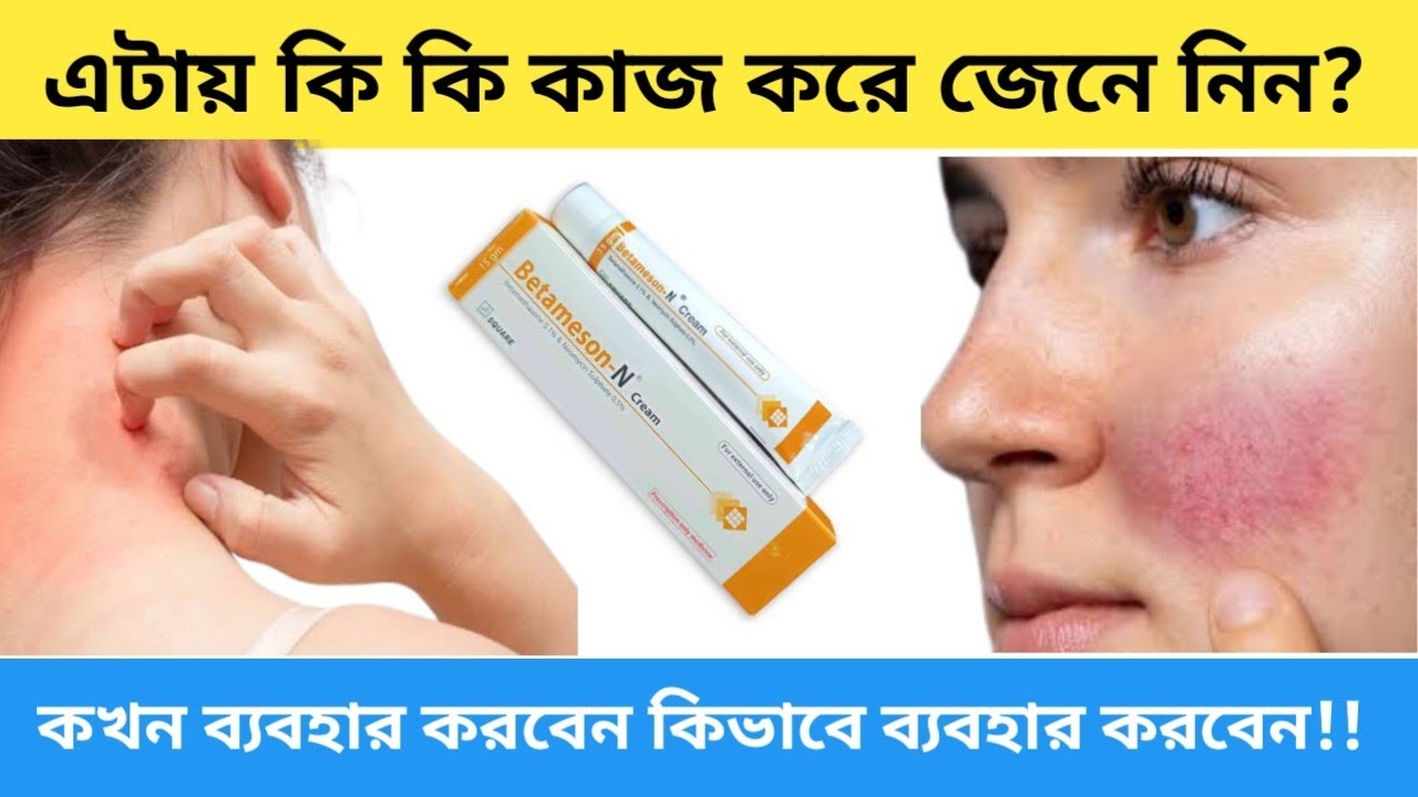 Betameson N Cream || সঠিক ব্যবহার || ত্বক ফসা করে নাকি নষ্ট করে || Bangla Review || সঠিক তথ্য জানুন 