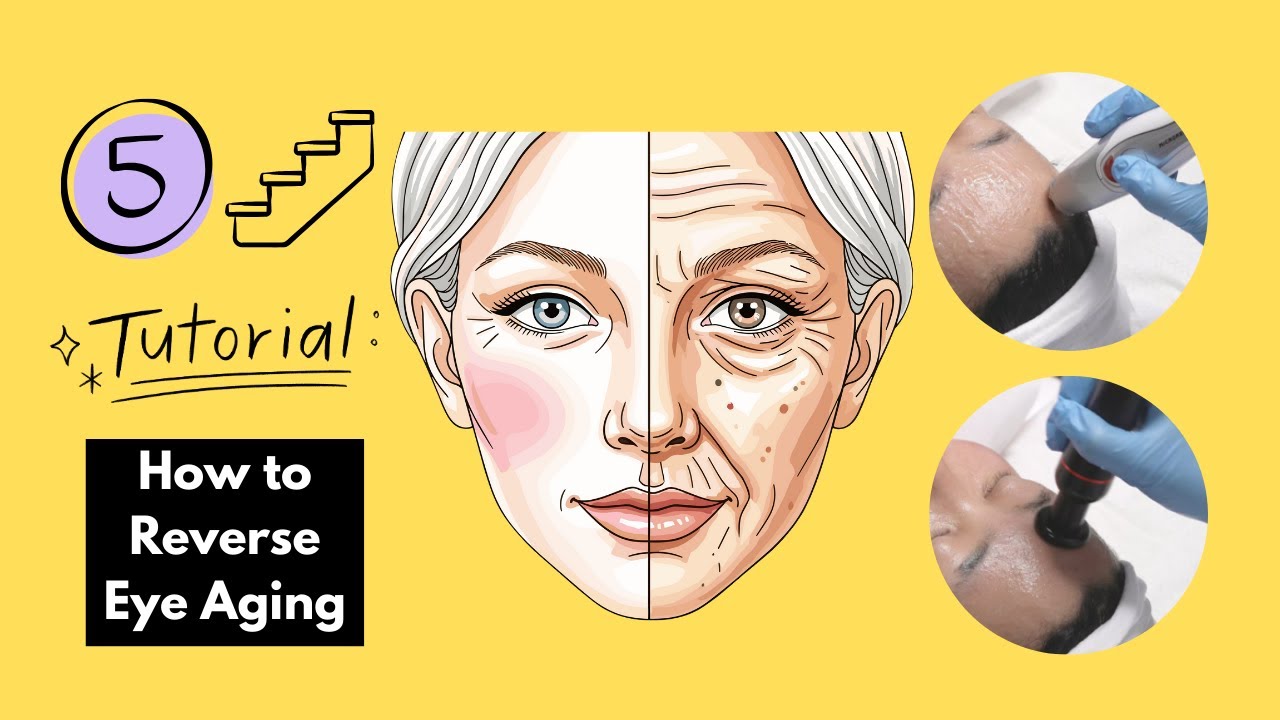 How to Reverse Eye Aging in 5 Steps | Facial Anti-aging Tips