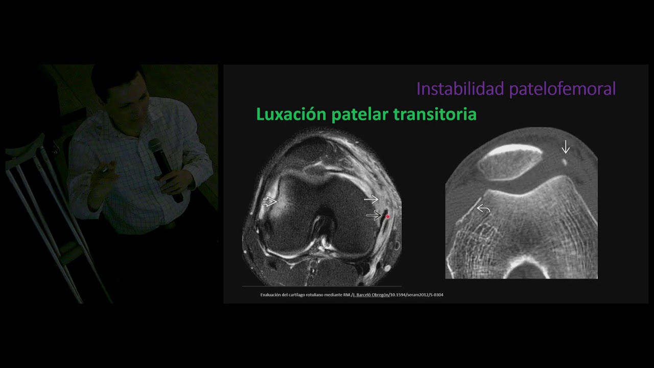 Inestabilidad patelofemoral. Dra. Kristyam Y. Jiménez Colindres