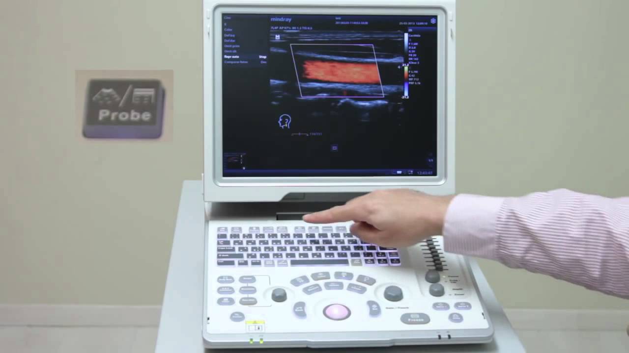 MINDRAY | Mindray Z6 Tutorial Spainish  Portable Color Doppler Diagnostic Ultrasound System