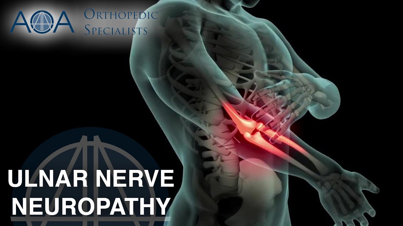 AOA Orthopedic Specialists - Ulnar Nerve Neuropathy