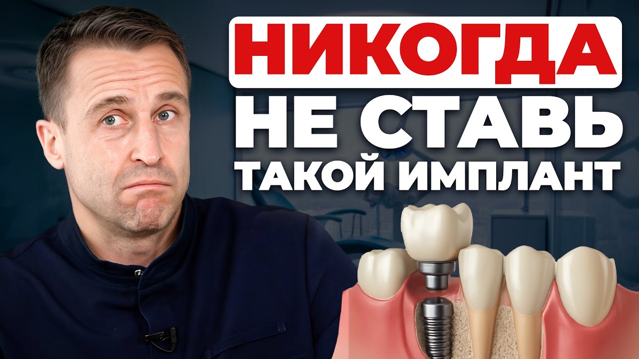Все виды ЗУБНЫХ ИМПЛАНТОВ в 1 видео! Какой имплант выбрать в 2026 году?