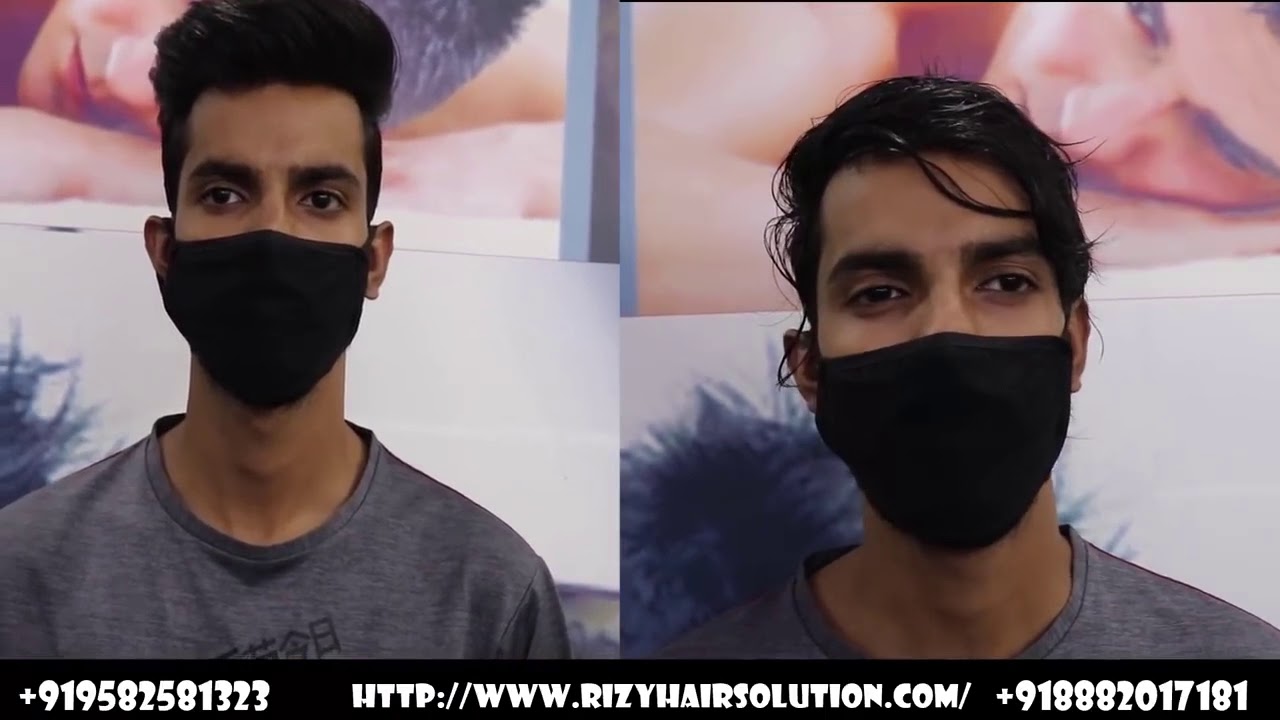BEFORE & AFTER  a non surgical hair fixing system wig patch