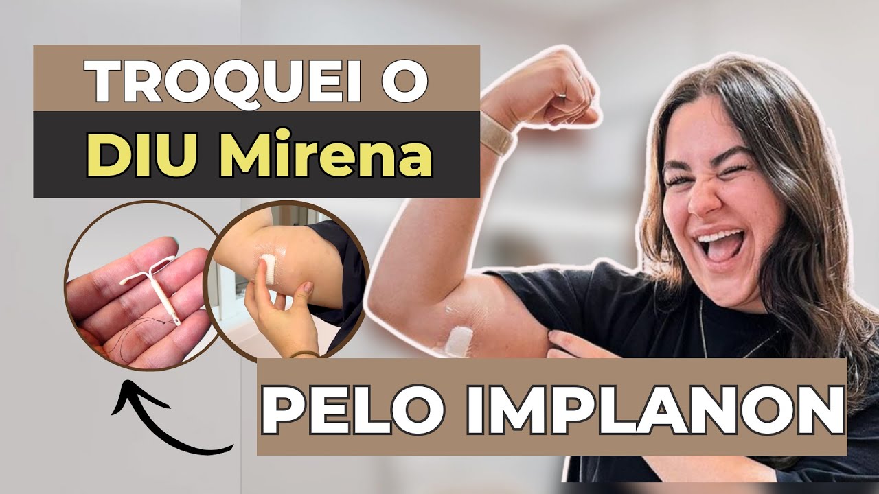 Tirei o DIU e coloquei Implanon: Minha Experi&ecirc;ncia